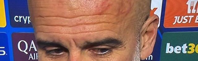 瓜帅：我挠破了脑袋，我想自残！阿克：3比1时保守了