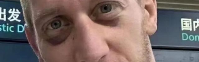 开云在线-贝里奇带伤火线驰援 津门虎客战大连人争10轮不败